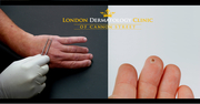 London Dermatology Clinic