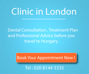 Dental implants abroad