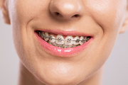 The Dentists at Gentle Dental Putney offers the best Treatment