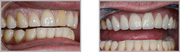 Gentle Dental Putney let you flaunt a perfect smile in Putney