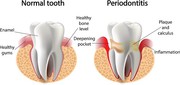 The duration between treatments at dentist India