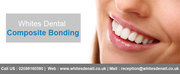 Composite Bonding At Wites Dental