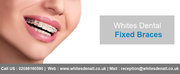 Braces Before And After At Whites Dental