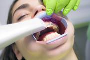 Laser teeth bleaching clinic in Turkey - Okutan Dental