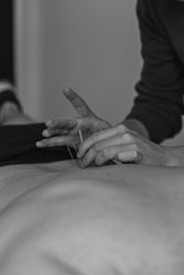 Targeted Medical Acupuncture for Effective Pain Relief