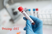 Fast HIV Testing in London – Results in 24 Hours