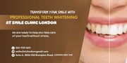 Transform Your Smile with Professional Teeth Whitening at Smile Clinic