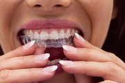 Is Invisalign Cost Stopping You from Smiling?
