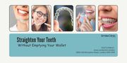 Straighten Your Teeth Without Emptying Your Wallet