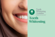 Professional Teeth Whitening Services Across London – Book Today