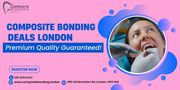 Affordable Composite Bonding Deals London - Premium Quality Guaranteed