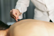 Acupuncture Treatment in Eastleigh – Wellspring Chinese Massage