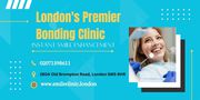 Instant Smile Enhancement - London's Premier Bonding Clinic