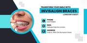 TRANSFORM YOUR SMILE WITH INVISALIGN BRACES – LONDON'S BEST! 