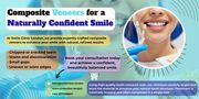 Composite Veneers for a Naturally Confident Smile – Smile Clinic Londo