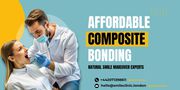 Affordable Composite Bonding | Natural Smile Makeover Experts