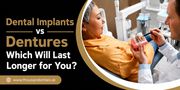 Dental Implants vs Dentures: Which Will Last Longer for You?