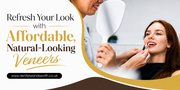 Refresh Your Look with Affordable,  Natural-Looking Veneers