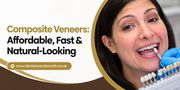 Composite Veneers: Affordable,  Fast & Natural-Looking